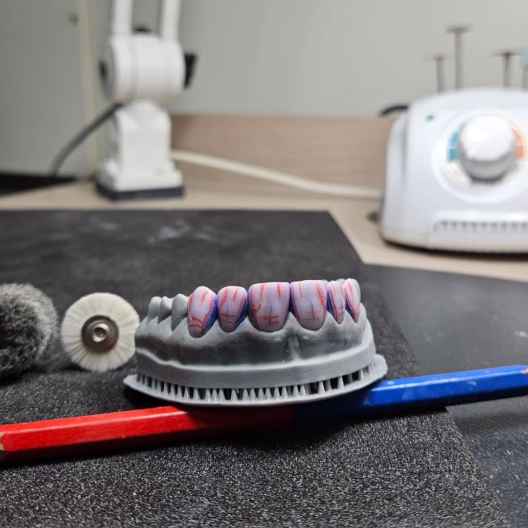 Proteses de fluxo digital 01