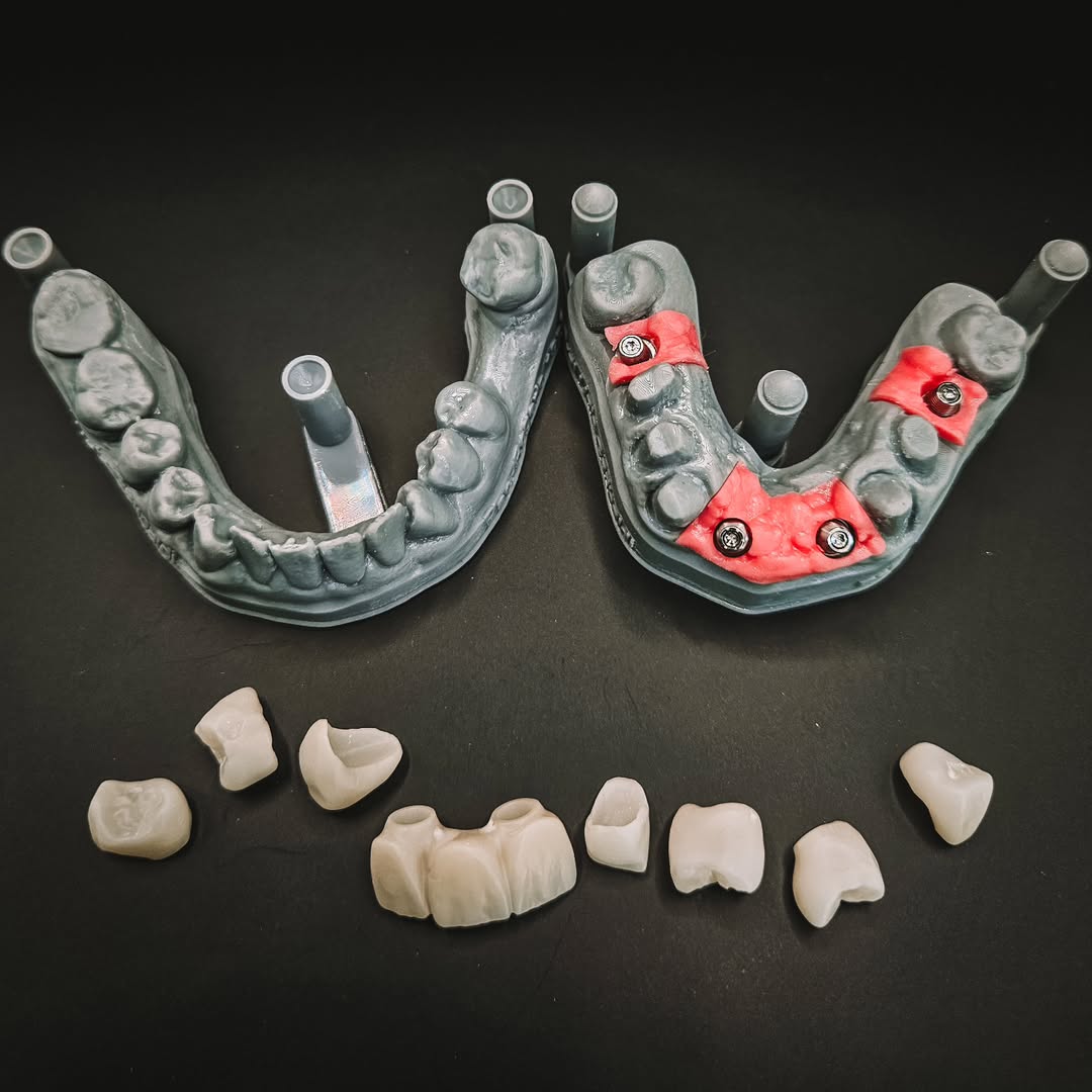 Proteses de fluxo digital 04