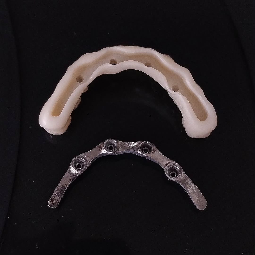 Proteses de fluxo digital 05