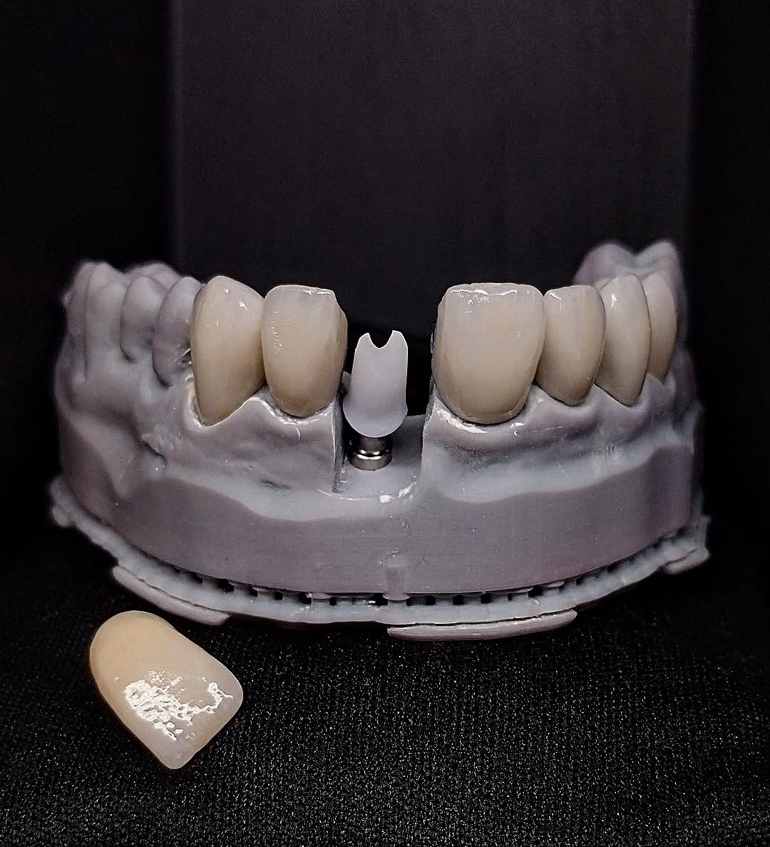 Proteses de fluxo digital 06